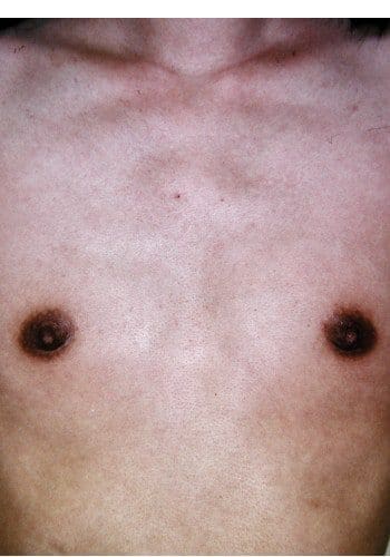 Close-up image of a human chest, showing two nipples and skin texture.