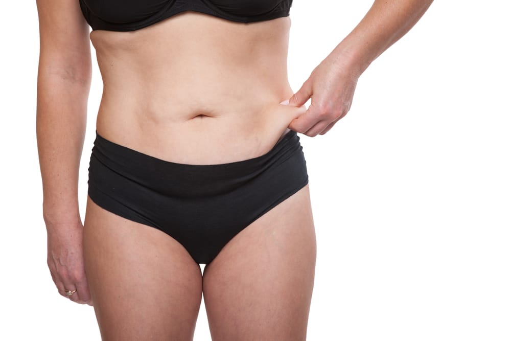 Cropped,Shot,Body,Woman,With,Excess,Weight,And,Subcutaneous,Fat.