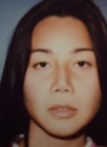 After Image: Facial Feminization - front