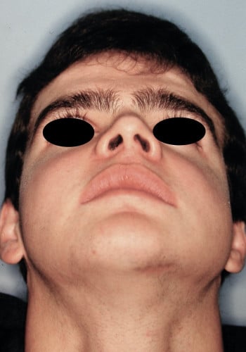 After Image: Maxillofacial - front