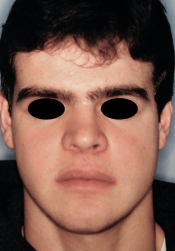 After Image: Maxillofacial - front