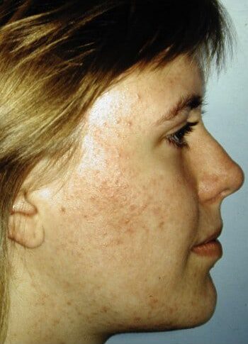After Image: Maxillofacial - right-side