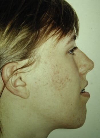 Before Image: Maxillofacial - right-side