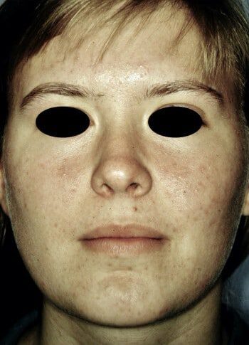 After Image: Maxillofacial - back