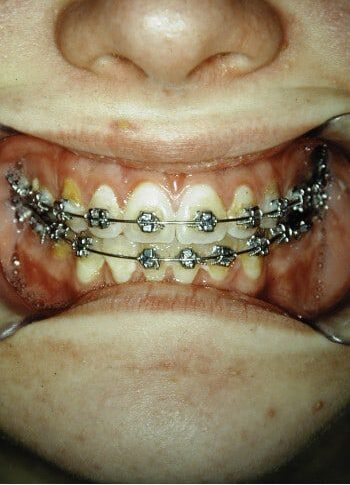 After Image: Maxillofacial - front