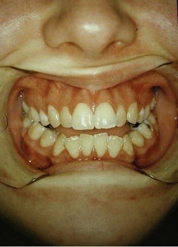 Before Image: Maxillofacial - front