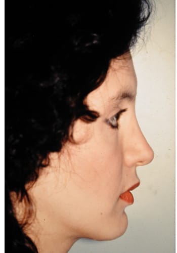 After Image: Maxillofacial - right-side