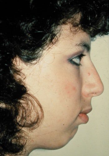 Before Image: Maxillofacial - right-side