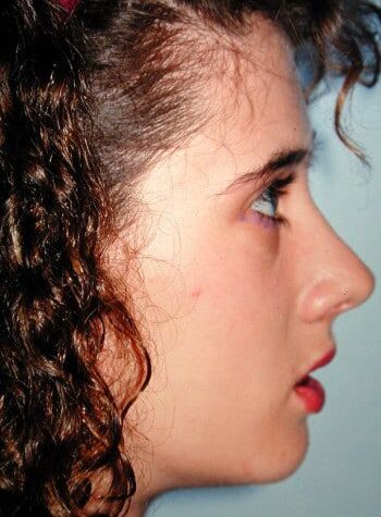 After Image: Maxillofacial - right-side