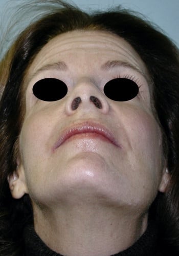 After Image: Maxillofacial - front