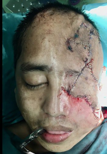 After Image: Craniofacial Tumors - front