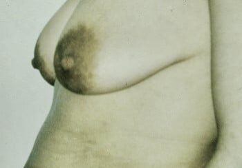 A woman with large breast and hairy armpit.