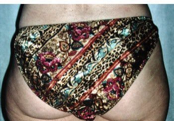 A woman 's bottom with a floral pattern on it.