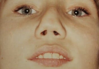 A close up of a person 's face with brown hair