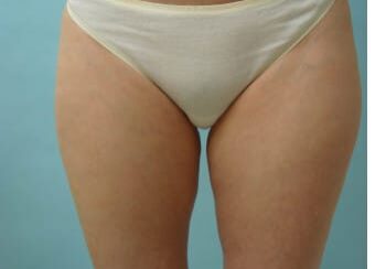 A woman 's legs and bottom in white underwear.