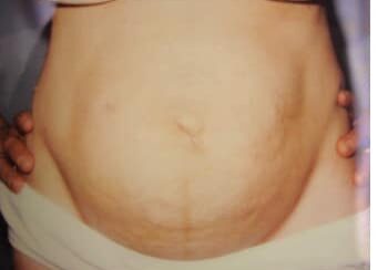 A woman 's stomach and abdomen in white underwear.