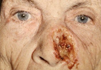 A close up of an old person with a face covered in blood