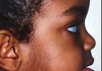 A close up of a child with one eye open