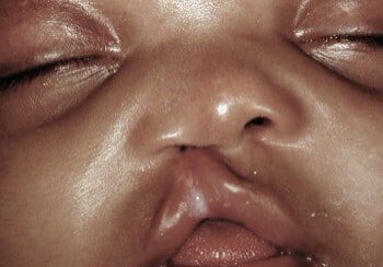 A close up of the face of a baby