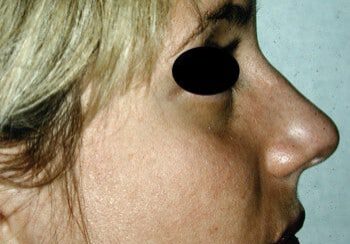 A woman with black circles on her face.