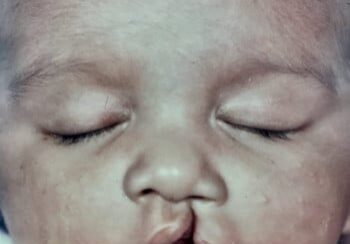 A baby with eyes closed and nose to mouth.