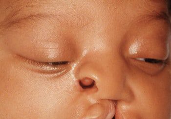 A close up of a child 's face with eyes closed