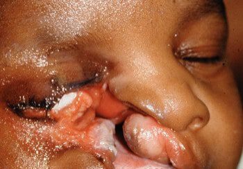 A close up of a child 's face with an open mouth.