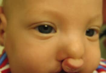 A baby with a large nose and a red, white and blue shirt.