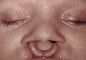 A close up of the face of a baby