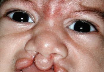 A close up of a baby 's face with an open mouth.