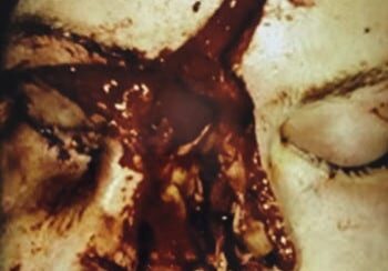 A close up of the face and blood on it.