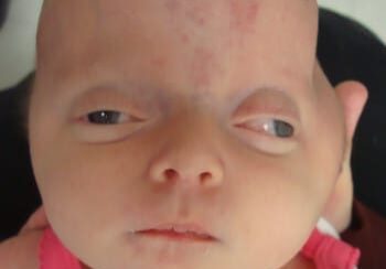 A baby with a bald head and pink shirt