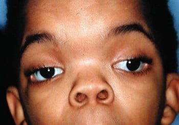 A young boy with large eyes and nose rings.