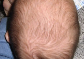 A close up of the head and neck of a baby