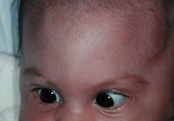 A baby with green eyes and brown hair.