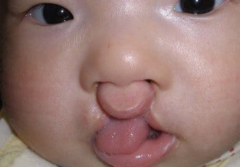 A baby with its tongue hanging out.