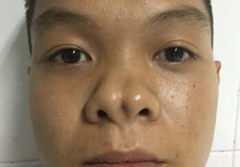 A close-up of a person with short hair and a neutral expression, looking directly at the camera against a white tiled background.