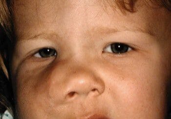 A young child with light brown hair and a serious facial expression looks directly at the camera. The child's front teeth are visible, and they are wearing a light-colored top.