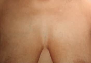 A close up of the breasts of a woman