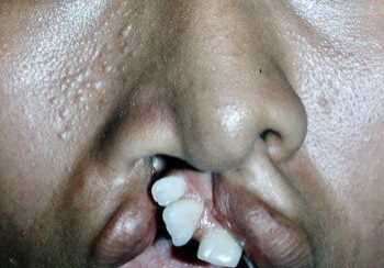 A close up of a person with their mouth open