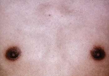 Close-up image of a human chest, showing two nipples and skin texture.