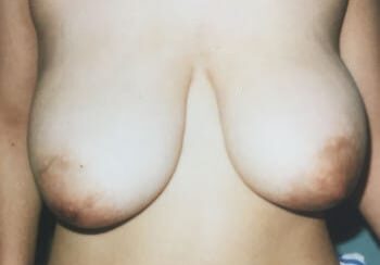 A woman with large breast and nipples.