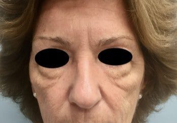 A woman with large eyes and wrinkles on her face.