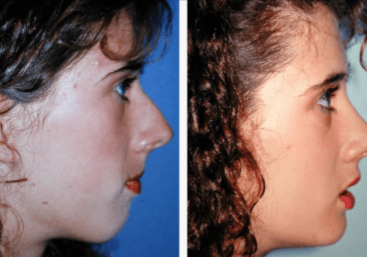 Maxillofacial-Gallery-Cases-McKinnon-Plastic-Surgery-11-04-2024_04_36_PM